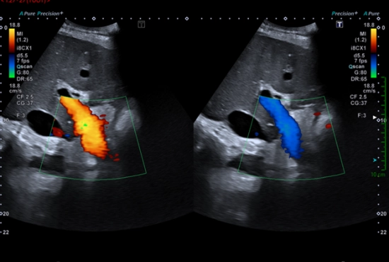 Un tronc porte soufflant le chaud et le froid